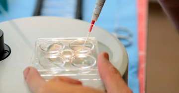 Искусствнное оплодотворение